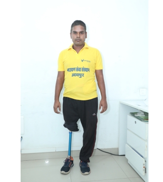 Read SUJIT'S ROAD TO RECOVERY WITH AN ARTIFICIAL LIMB success story