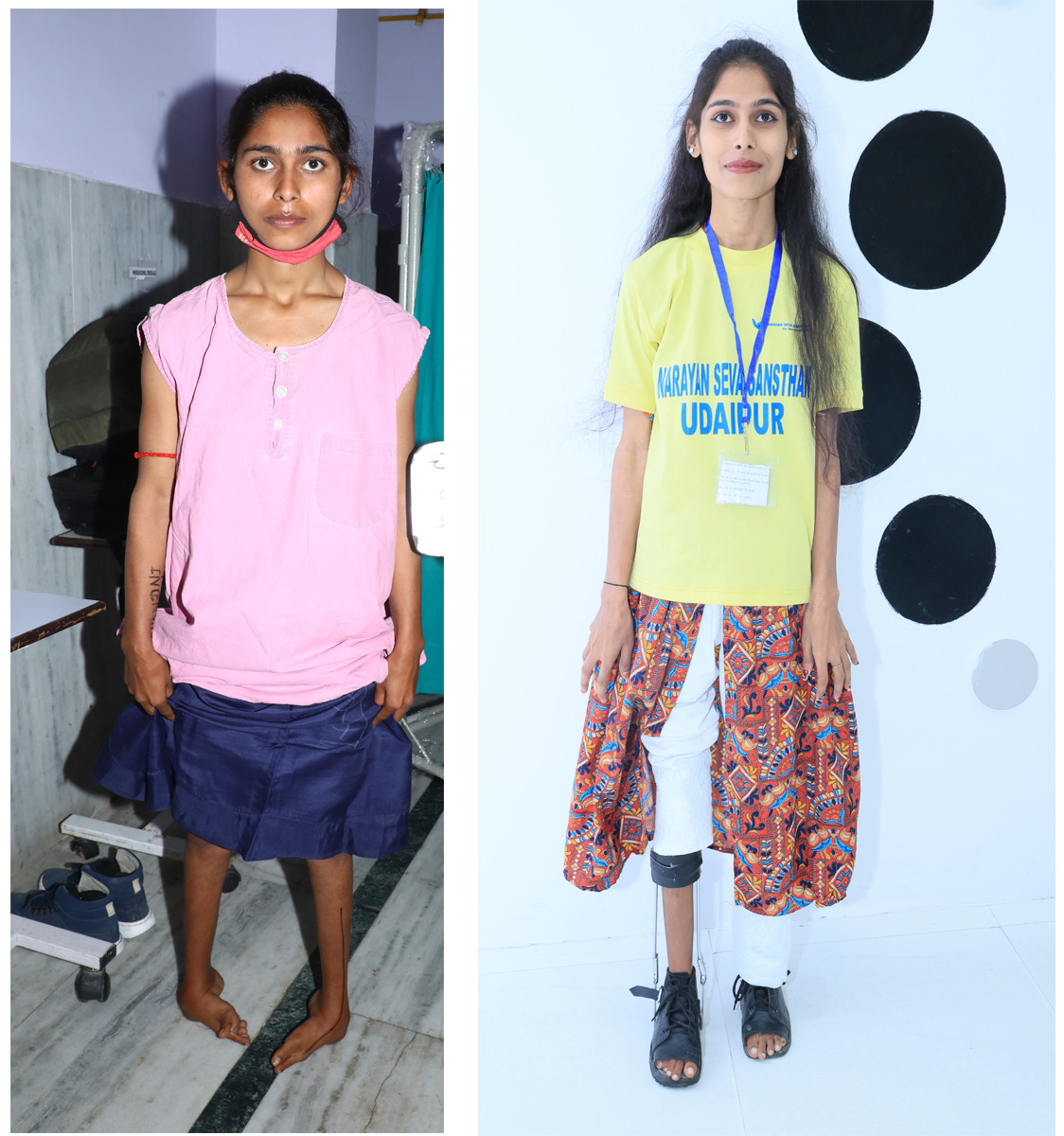 Read Chandni Success Story