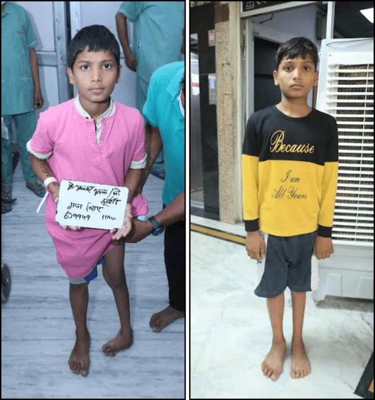 Success story of आलम