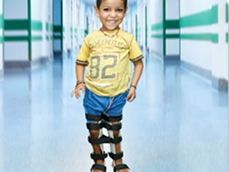 ਨਾਰਾਇਣ ਆਰਟੀਫੀਸ਼ੀਅਲ ਲਿਮਬ